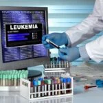 Blood Test May Detect Leukemia Risk