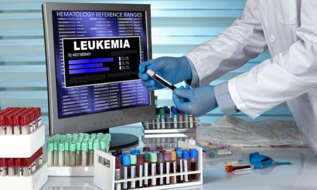 Blood Test May Detect Leukemia Risk
