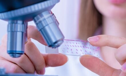 Cancer Screenings Continue Years After Guidelines Change to Limit Unnecessary Tests