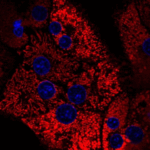 Clinically Validated Collagenase and Neutral Protease Enzymes Available
