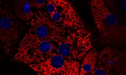 Clinically Validated Collagenase and Neutral Protease Enzymes Available