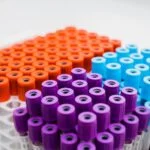AI ‘Fragle’ Method Makes Cancer Tracking More Efficient