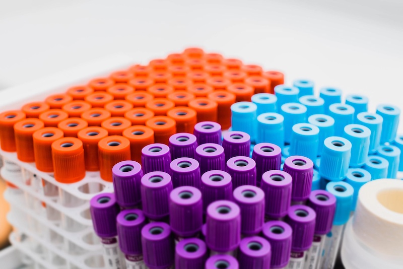 AI ‘Fragle’ Method Makes Cancer Tracking More Efficient