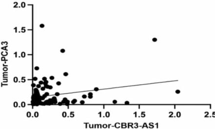 Gastric Cancer Biomarkers Identified in New Study