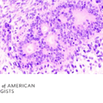 Immunohistochemistry Can Act as a Surrogate to Aid Difficult Diagnoses of Soft Tissue Tumors