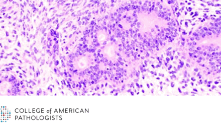 Immunohistochemistry Can Act as a Surrogate to Aid Difficult Diagnoses of Soft Tissue Tumors