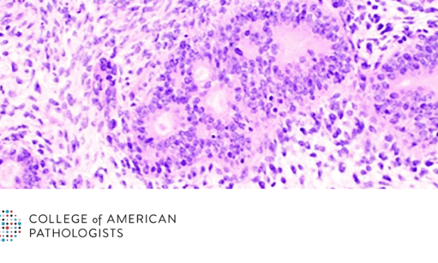 Immunohistochemistry Can Act as a Surrogate to Aid Difficult Diagnoses of Soft Tissue Tumors