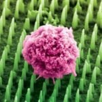 Nanoneedle Patch Could Replace Painful Cancer Biopsies