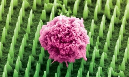 Nanoneedle Patch Could Replace Painful Cancer Biopsies