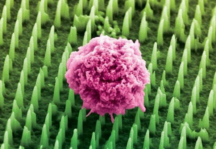 Nanoneedle Patch Could Replace Painful Cancer Biopsies