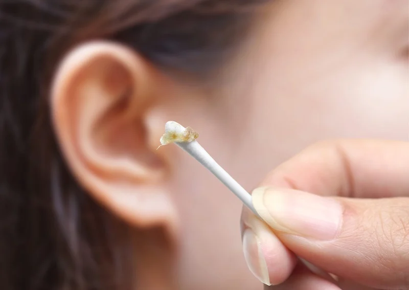 Parkinson’s Disease: Are Ear Wax VOCs a Path to Diagnosis?