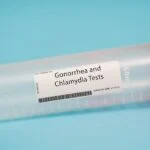 Rapid Testing for STIs on the Horizon