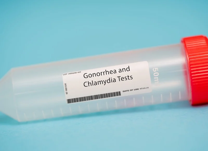 Rapid Testing for STIs on the Horizon