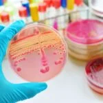 Rapid Diagnostic Slashes Sepsis Mortality by 39%