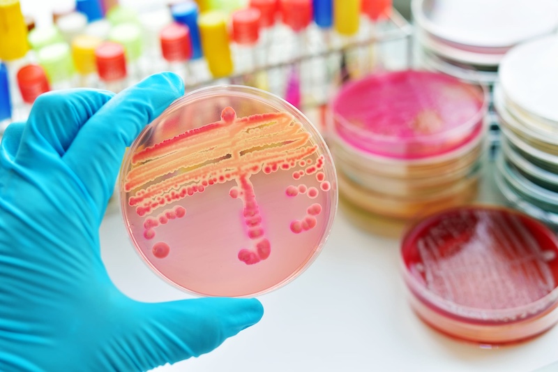 Rapid Diagnostic Slashes Sepsis Mortality by 39%