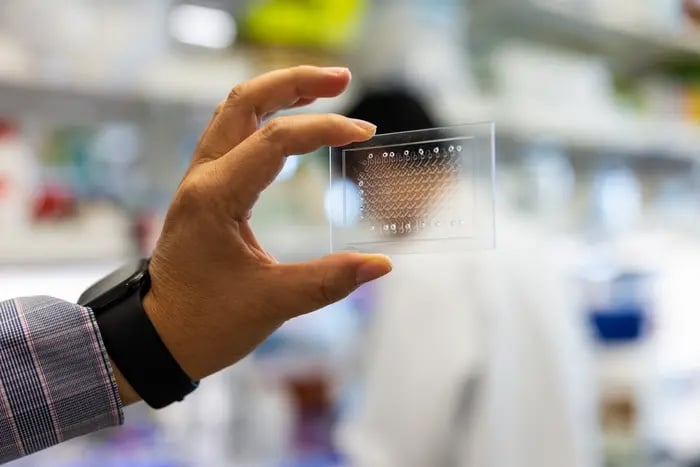 TB Test Could Close the Diagnostic Gap in HIV hotspots