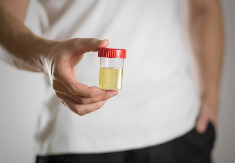 TOBY Urine Test Completes Participation in 2025 Mayo Clinic and ASU Alliance for Health Care MedTech Accelerator