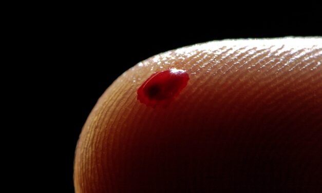 Tip Optofluidic Immunoassay Delivers Immune Profile with One Drop of Blood