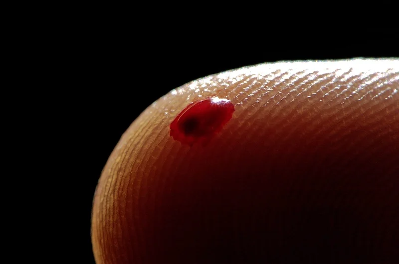Tip Optofluidic Immunoassay Delivers Immune Profile with One Drop of Blood