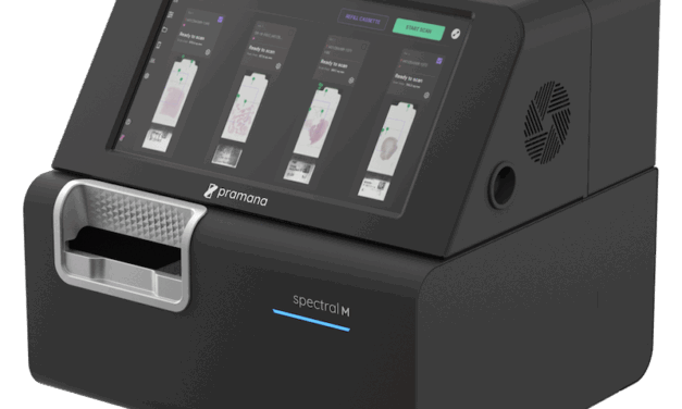 Volumetric Digital Scanning Gets AI Boost