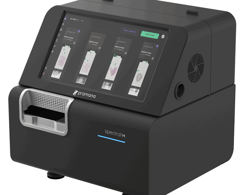 Volumetric Digital Scanning Gets AI Boost
