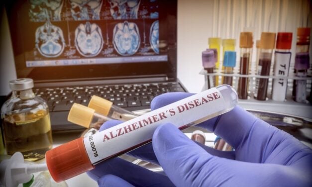 Quest Diagnostics to Offer Fujirebio Blood Test for Alzheimer’s