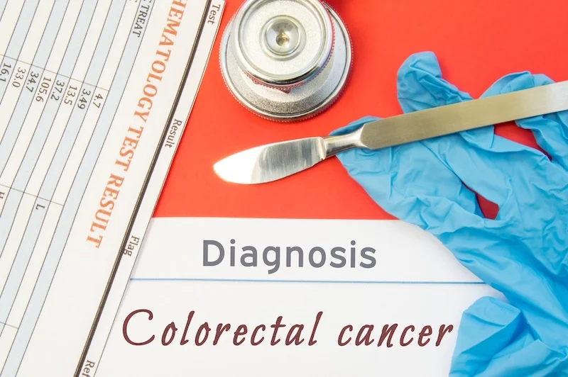 Personalis Expands Tempus Strategic Collaboration to Bring Ultra-Sensitive Cancer Recurrence Testing to Colorectal Cancer Patients