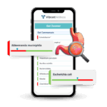 Gut Zoomer Gets Upgrade, Adds Microbial and Metabolic Insights