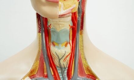 LIMA1-Alpha Protein Predicts Head and Neck Cancer Patients who Can Be Cured with Surgery Alone