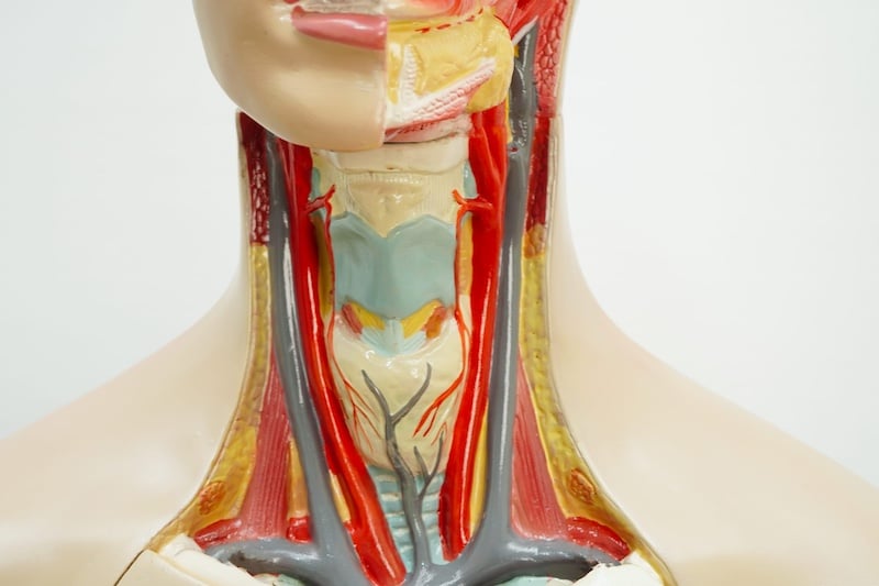 LIMA1-Alpha Protein Predicts Head and Neck Cancer Patients who Can Be Cured with Surgery Alone