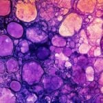 PanTracer Tissue and PanTracer Tissue + HRD Are Now Available