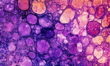 PanTracer Tissue and PanTracer Tissue + HRD Are Now Available
