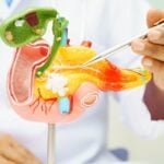 ClearNote Health Receives UKCA Mark for Avantect Pancreatic Cancer Test