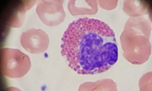 Scopio Labs Receives FDA Clearance for Decision Support System on X100 and X100HT Platforms