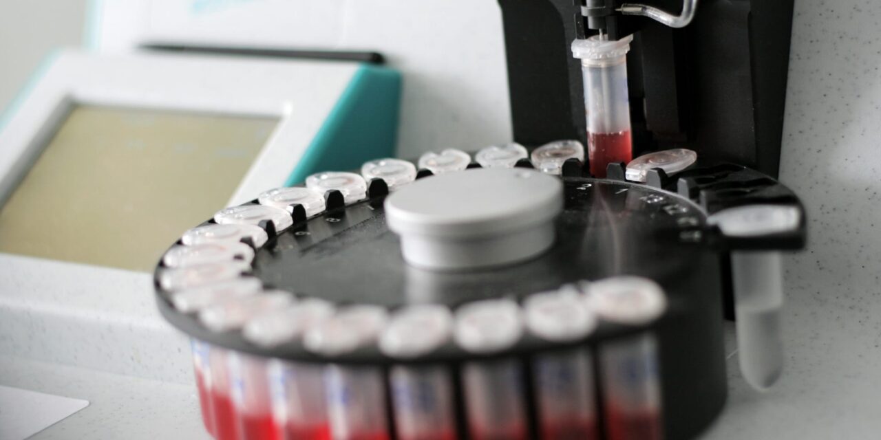 Blood-Based Biomarker Testing for Alzheimer’s Gets Formal Guidance