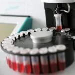 Blood-Based Biomarker Testing for Alzheimer’s Gets Formal Guidance
