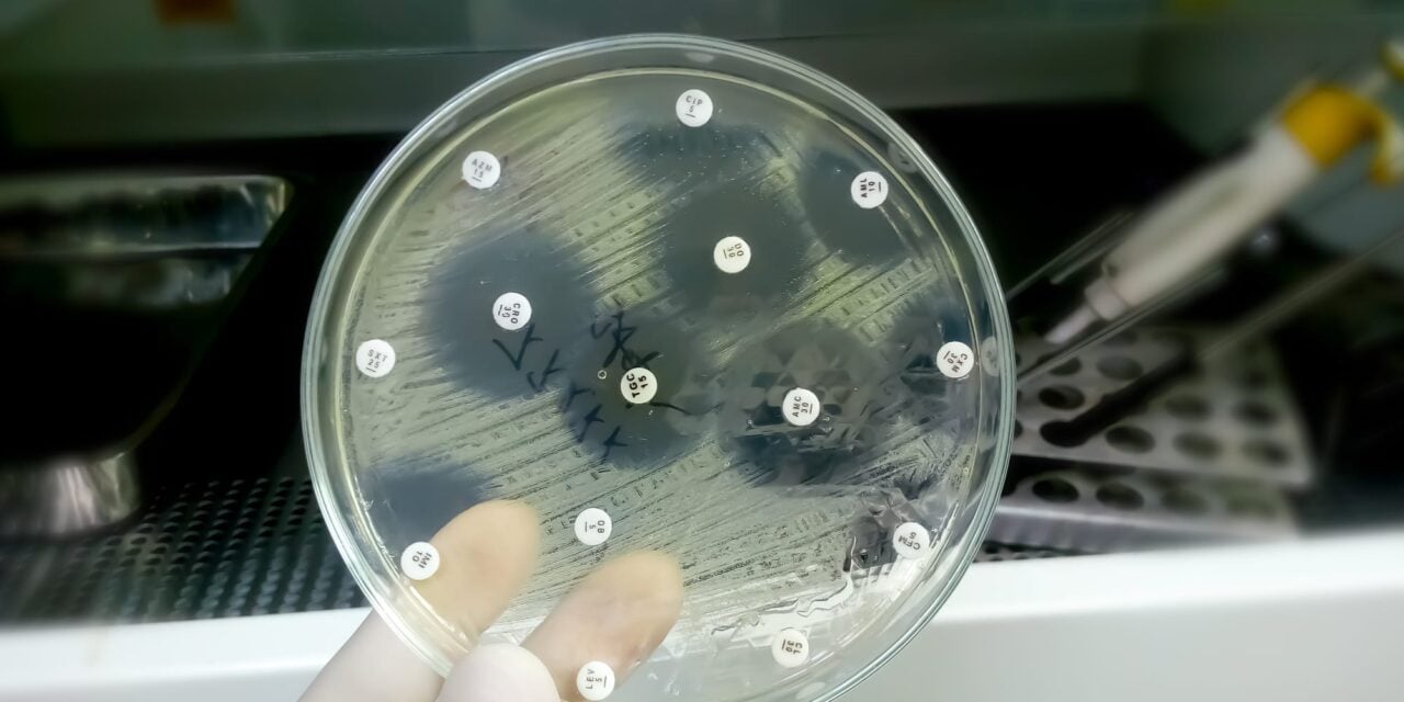 New Guidance on Modifications to Antimicrobial Susceptibility Testing