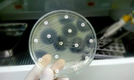 New Guidance on Modifications to Antimicrobial Susceptibility Testing