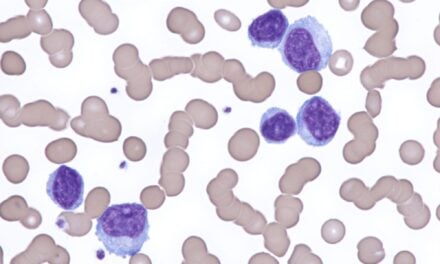Ultrasensitive MRD Test Shows Greater Prognostic Accuracy Than PET/CT in Lymphoma