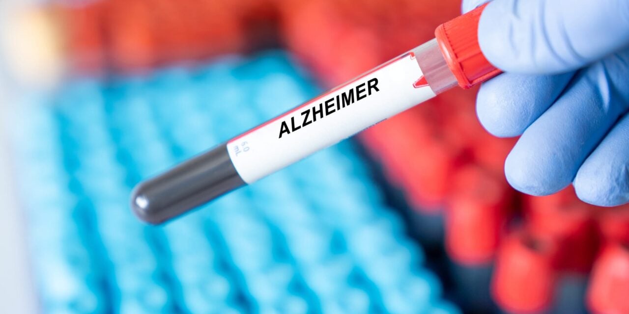 pTau217 Antibody Demonstrates Reliability for Alzheimer’s Detection