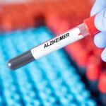 pTau217 Antibody Demonstrates Reliability for Alzheimer’s Detection