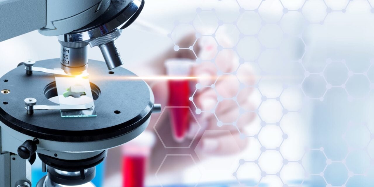 Liquid Biopsy Assay Shows Superior Sensitivity in Head-to-Head Study