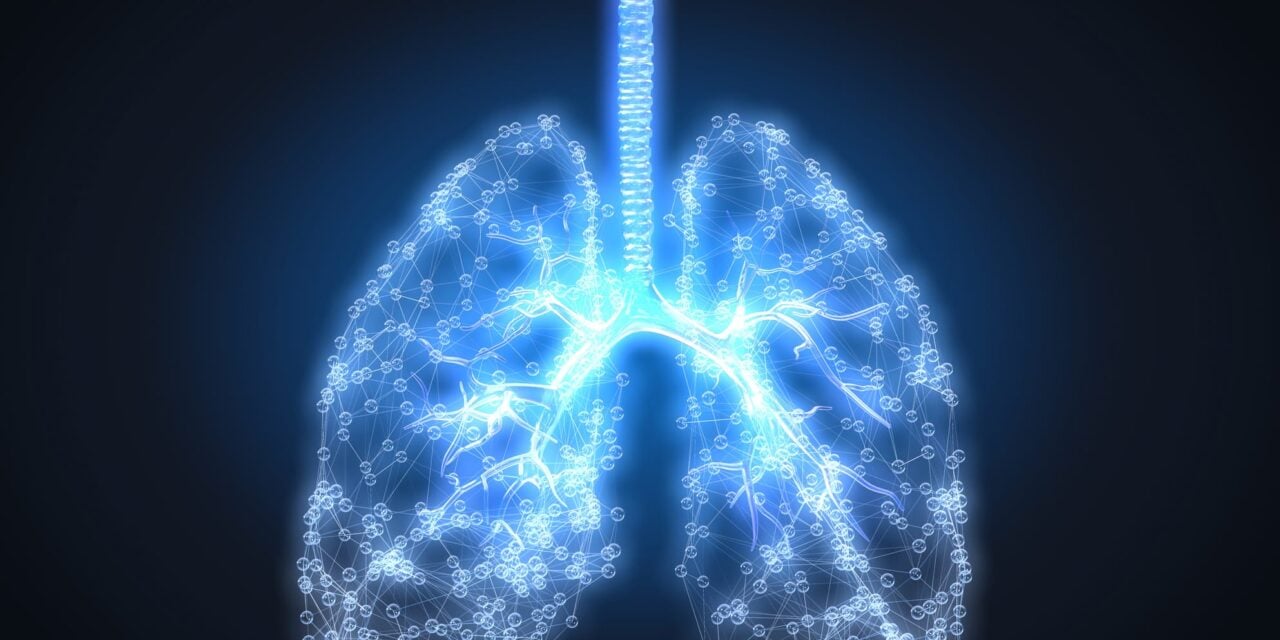 CyPath Lung Flags Early-Stage Cancer Overlooked by Previous Tests