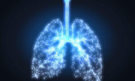 CyPath Lung Flags Early-Stage Cancer Overlooked by Previous Tests