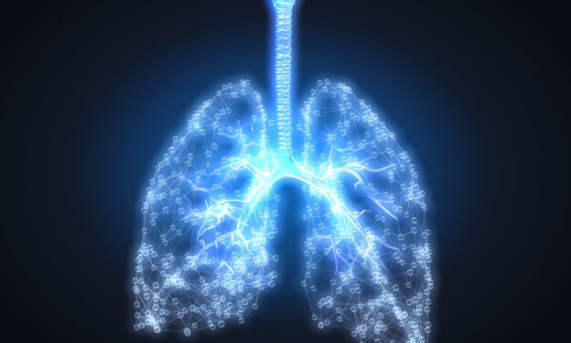 CyPath Lung Flags Early-Stage Cancer Overlooked by Previous Tests
