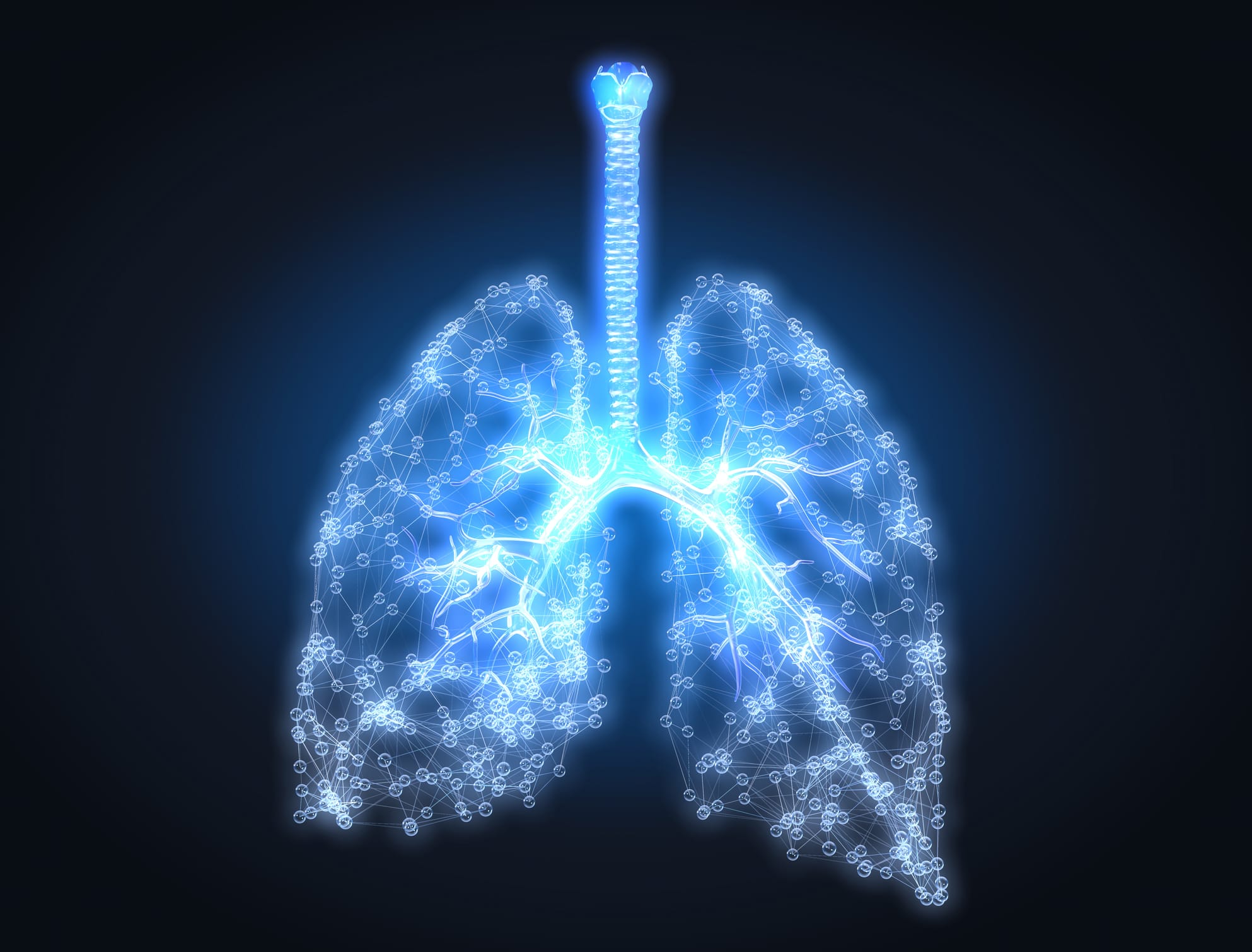 CyPath Lung Flags Early-Stage Cancer Overlooked by Previous Tests ...