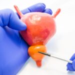 FDA Grants De Novo Authorization for AI-Powered Prostate Cancer Prognostic Software