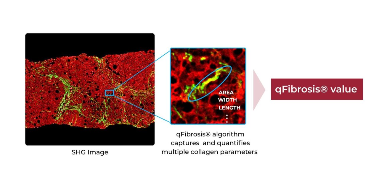 HistoIndex Launches AI-Powered Fibrosis Assessment Test for MASH Diagnosis