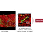 HistoIndex Launches AI-Powered Fibrosis Assessment Test for MASH Diagnosis