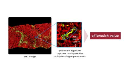 HistoIndex Launches AI-Powered Fibrosis Assessment Test for MASH Diagnosis